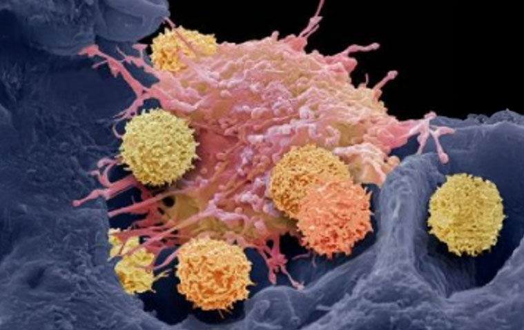 Autoimmunity
